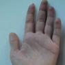 Palec Ošklivý palec na ruce