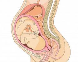 Lašintuvas – magnis – nėštumo metu