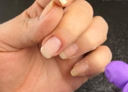How to properly remove gel or acrylic nails